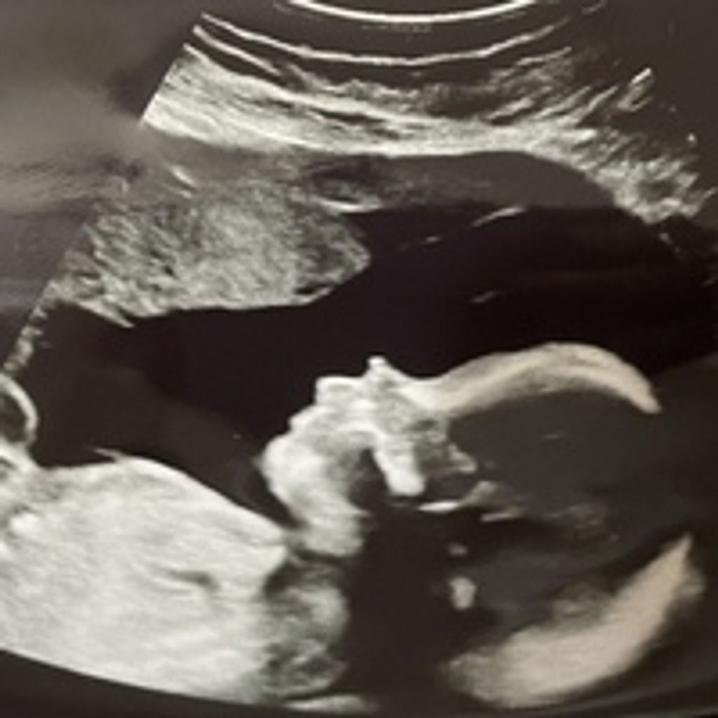 Baby Asher Micah Ewart Profile Photo