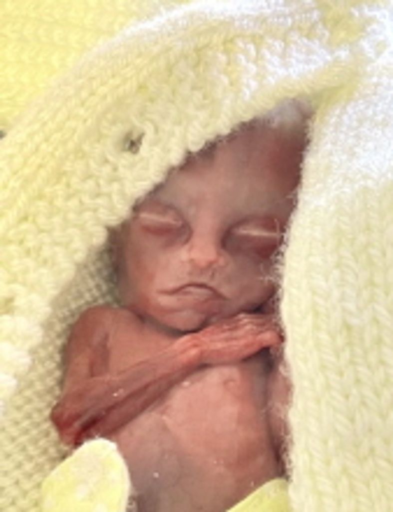 Blakeleigh Myra Lynch