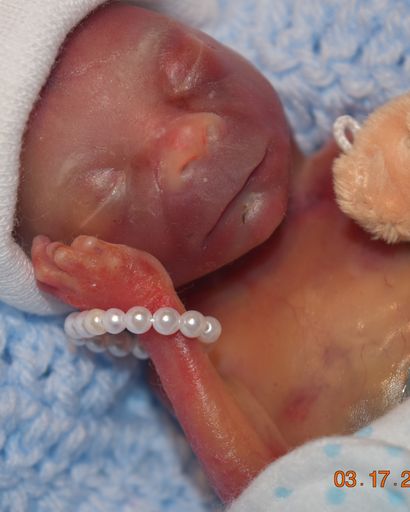 Acse Leon Smith's obituary image