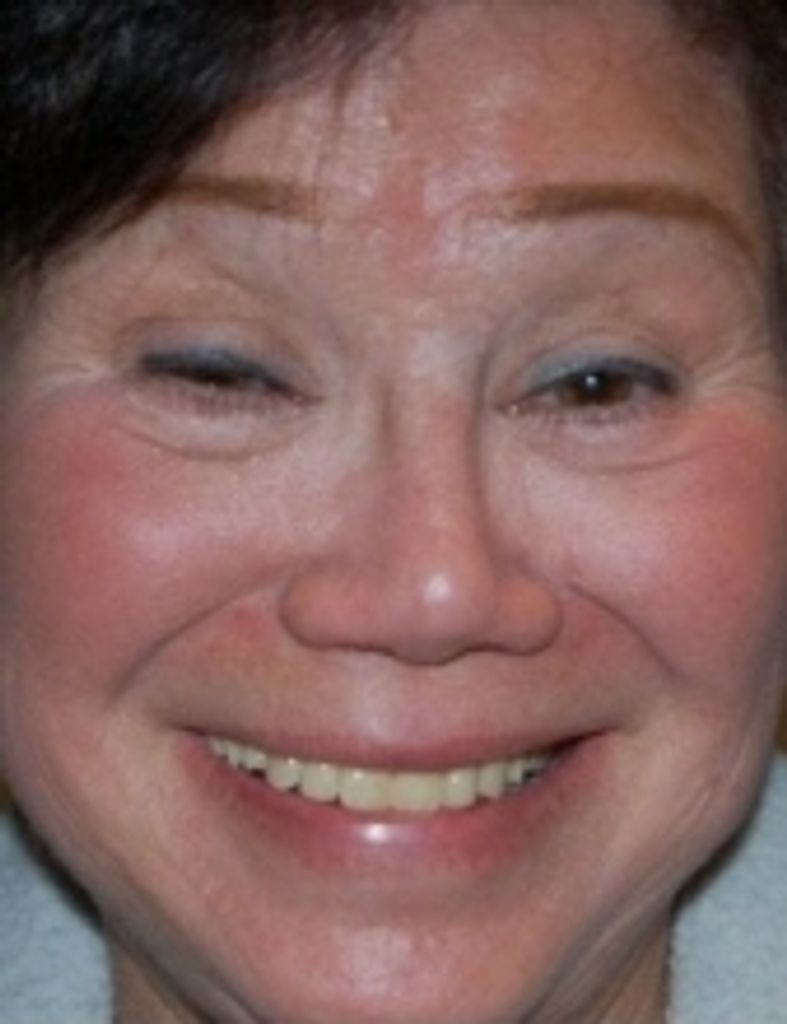 Eleonor Bayer