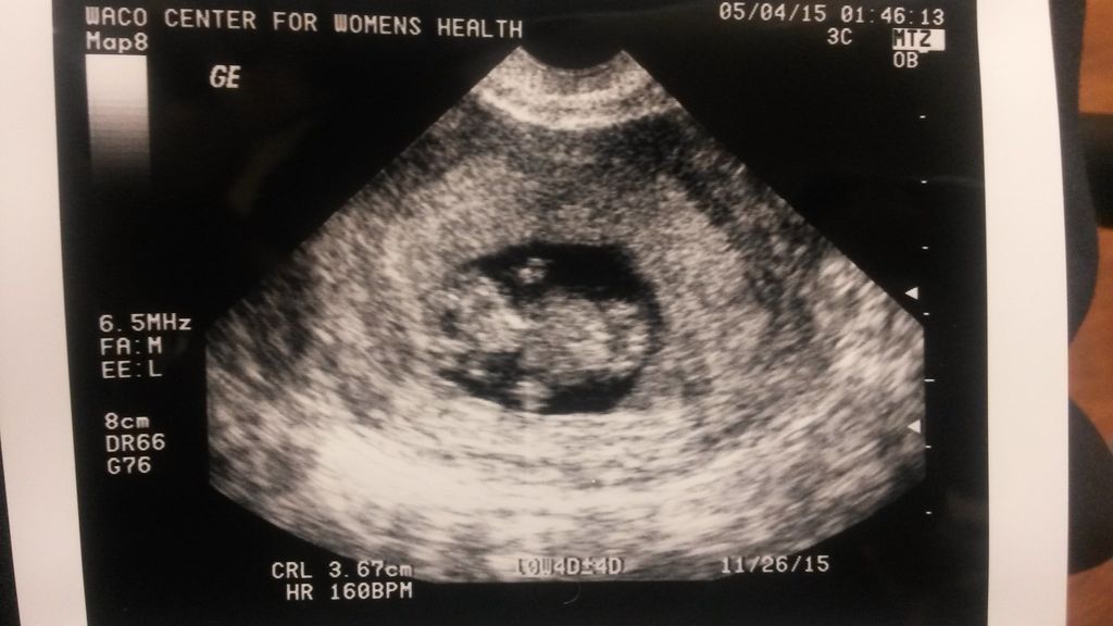 Karsyn Wright Profile Photo