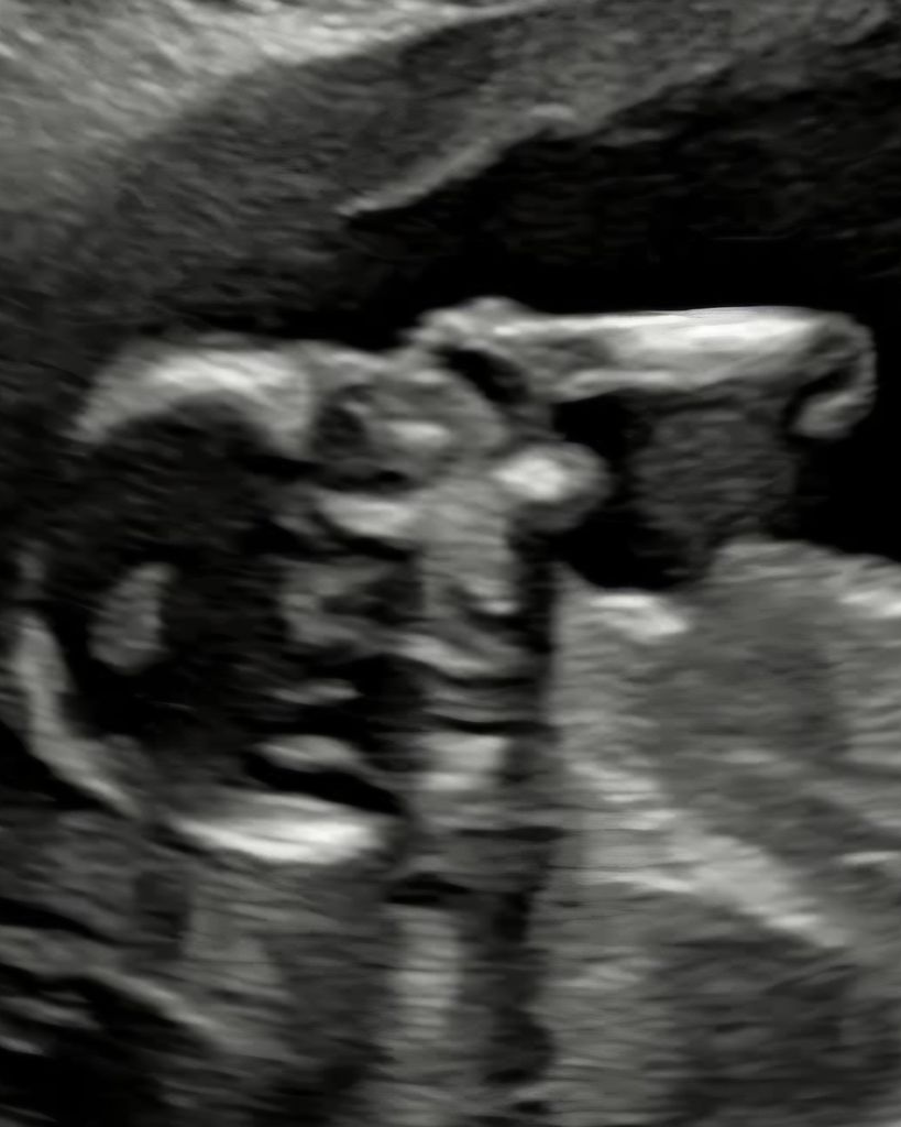 Otto Zane Hildebrandt-Farmer