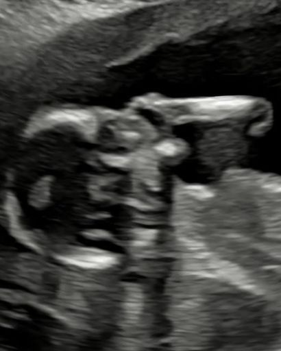 Otto Zane Hildebrandt-Farmer's obituary image