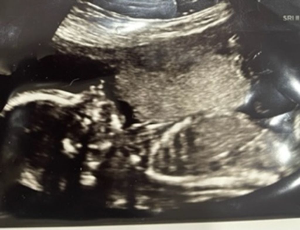 Infant Addison Nicole Weekley Profile Photo