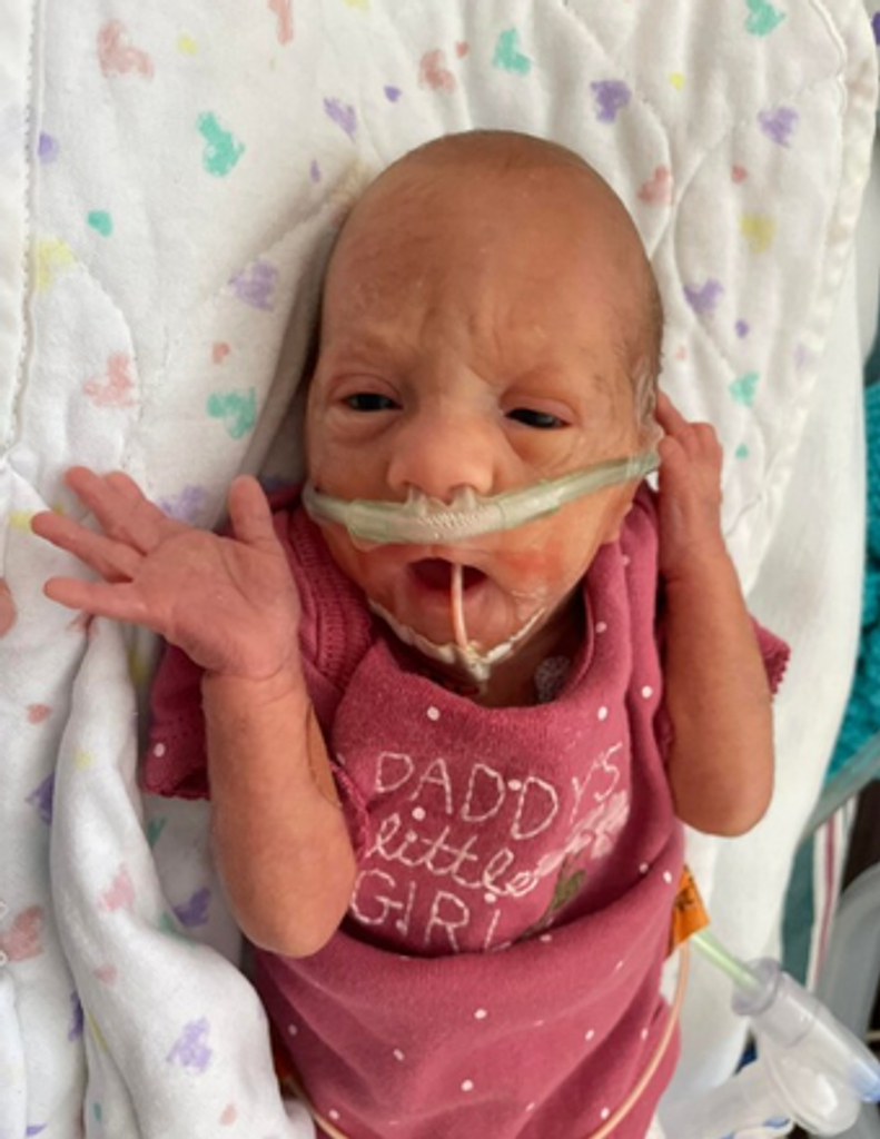 Dixie Jean Kinser Profile Photo