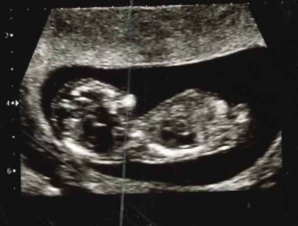 Aiden Michael Slaughter