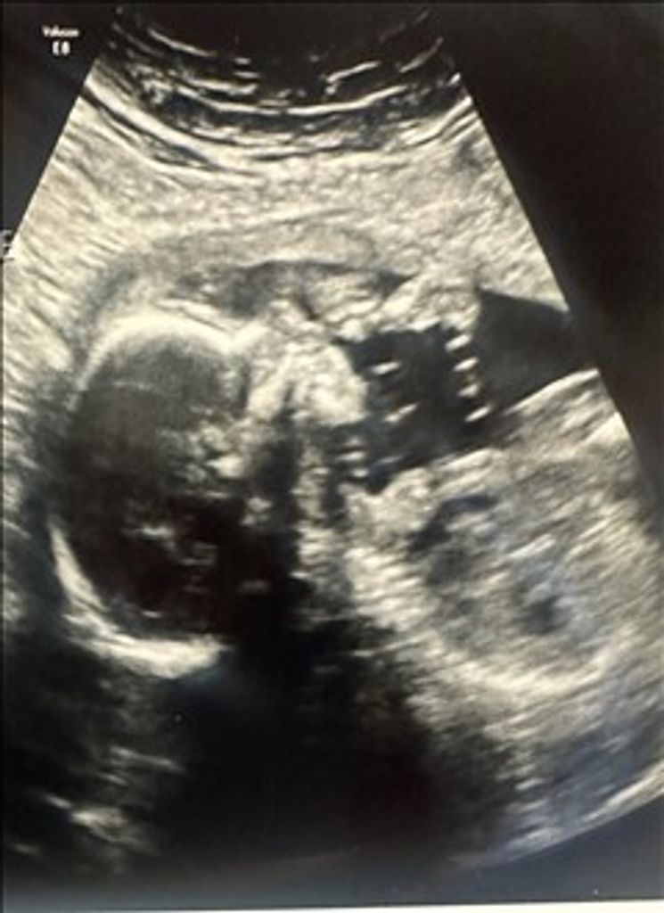 Alyssa Ann Owens Profile Photo