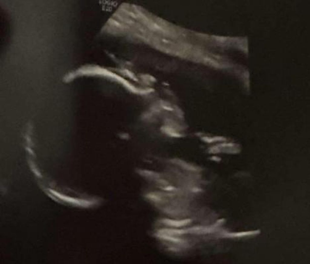 Baby Rene Del Bosque Iii Profile Photo