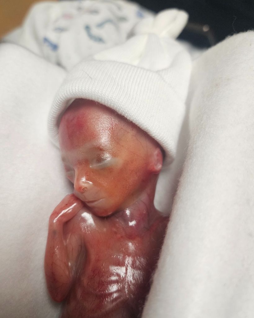 Landon Gregory Snarr