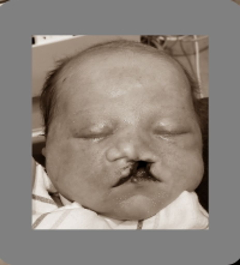 Xander Elliott Flora