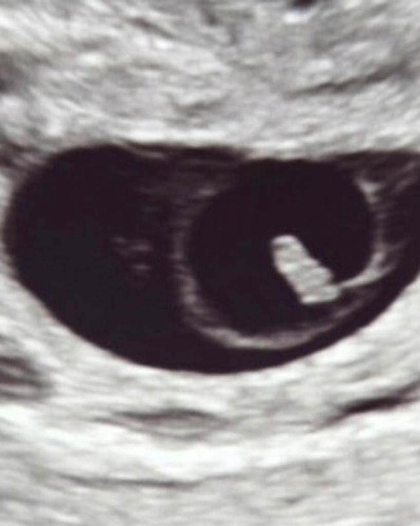 Oakley Rayne Lee Profile Photo