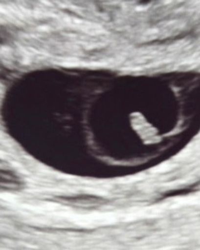 Oakley Rayne Lee's obituary image