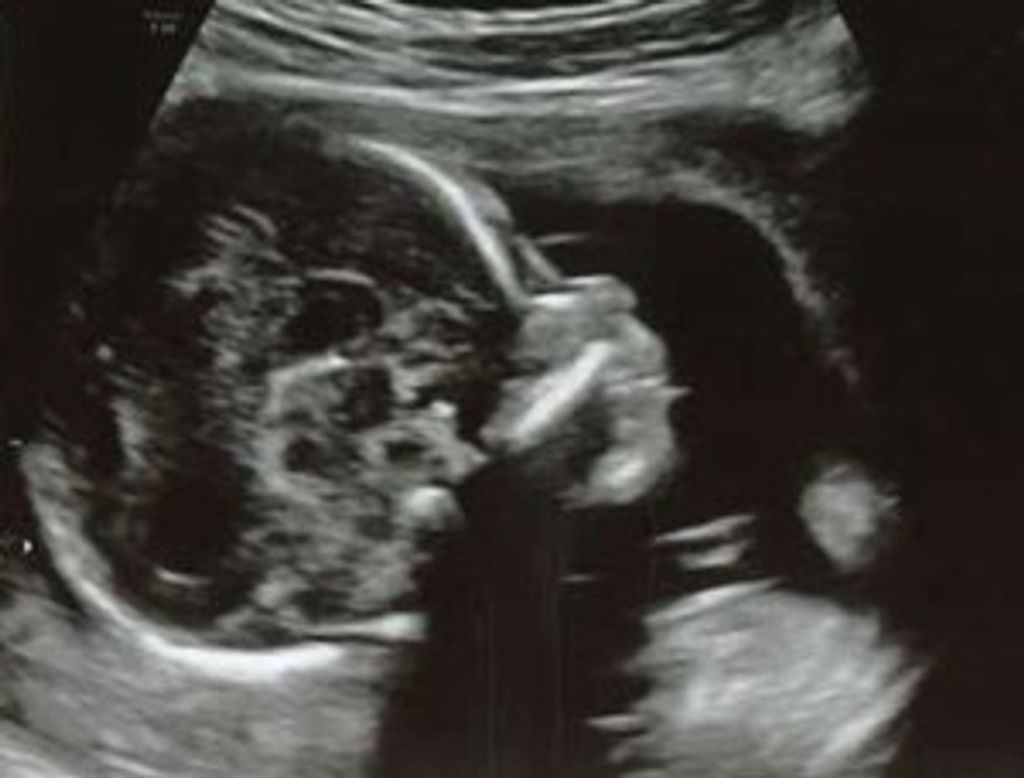 Karsyn Charles Combs