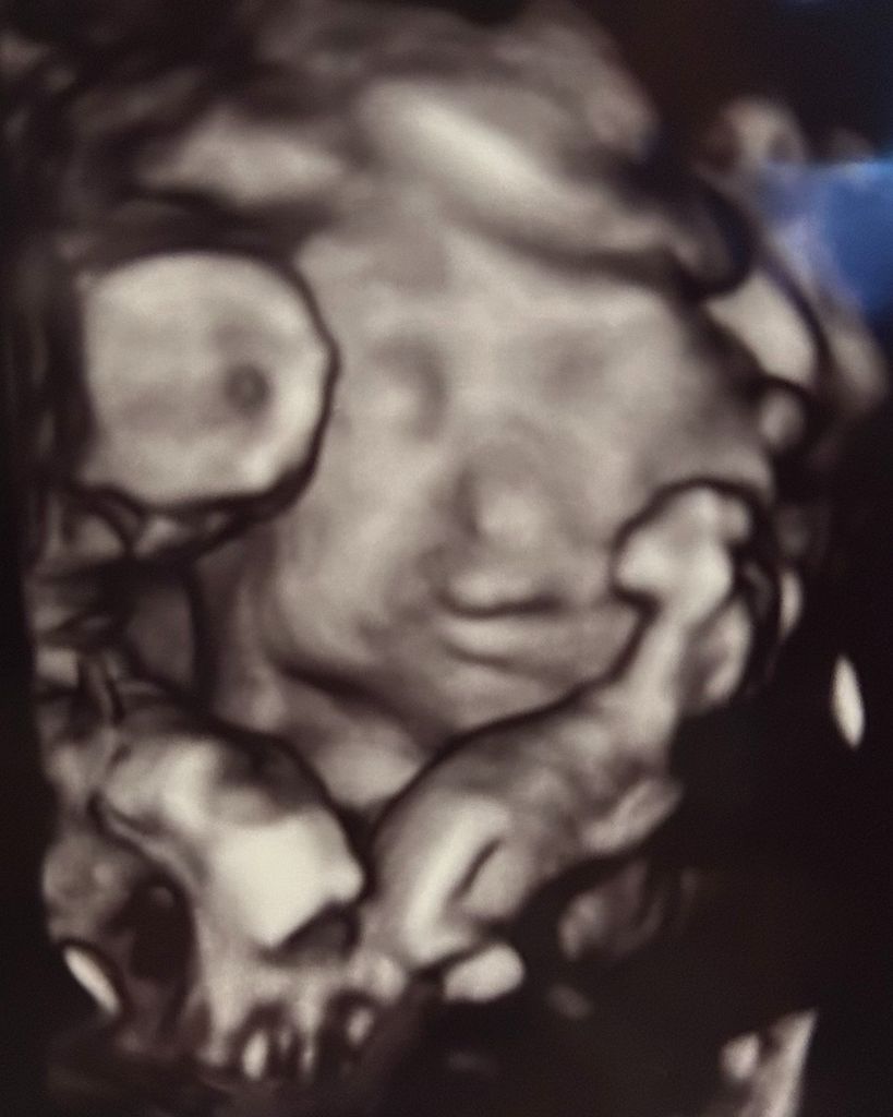 Leia Meadow Teixeira Profile Photo