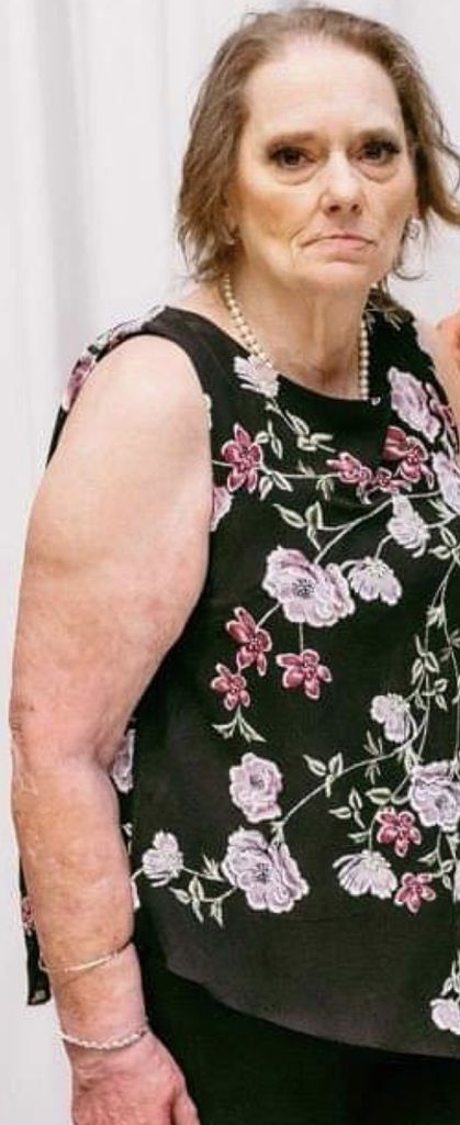 Christine Bene