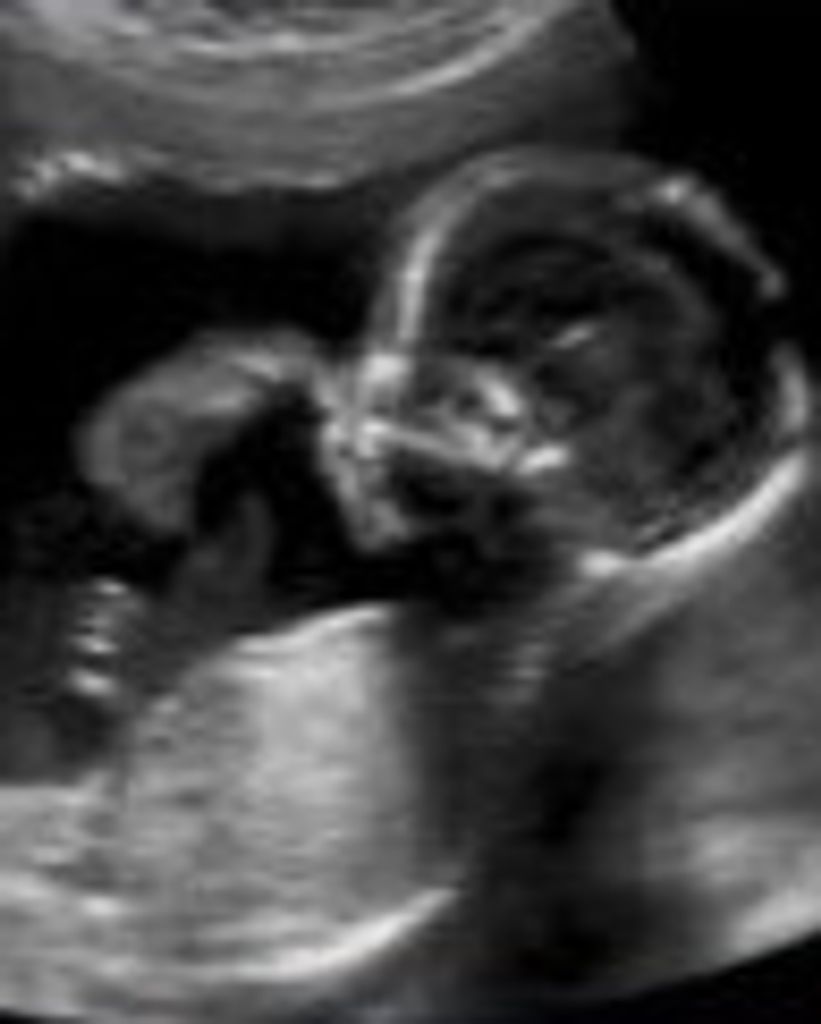 Tristan James Barrett Profile Photo