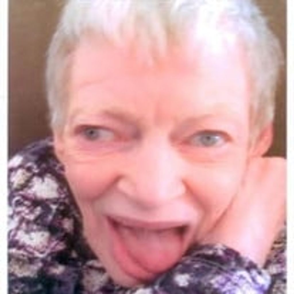 Lois Skoglund