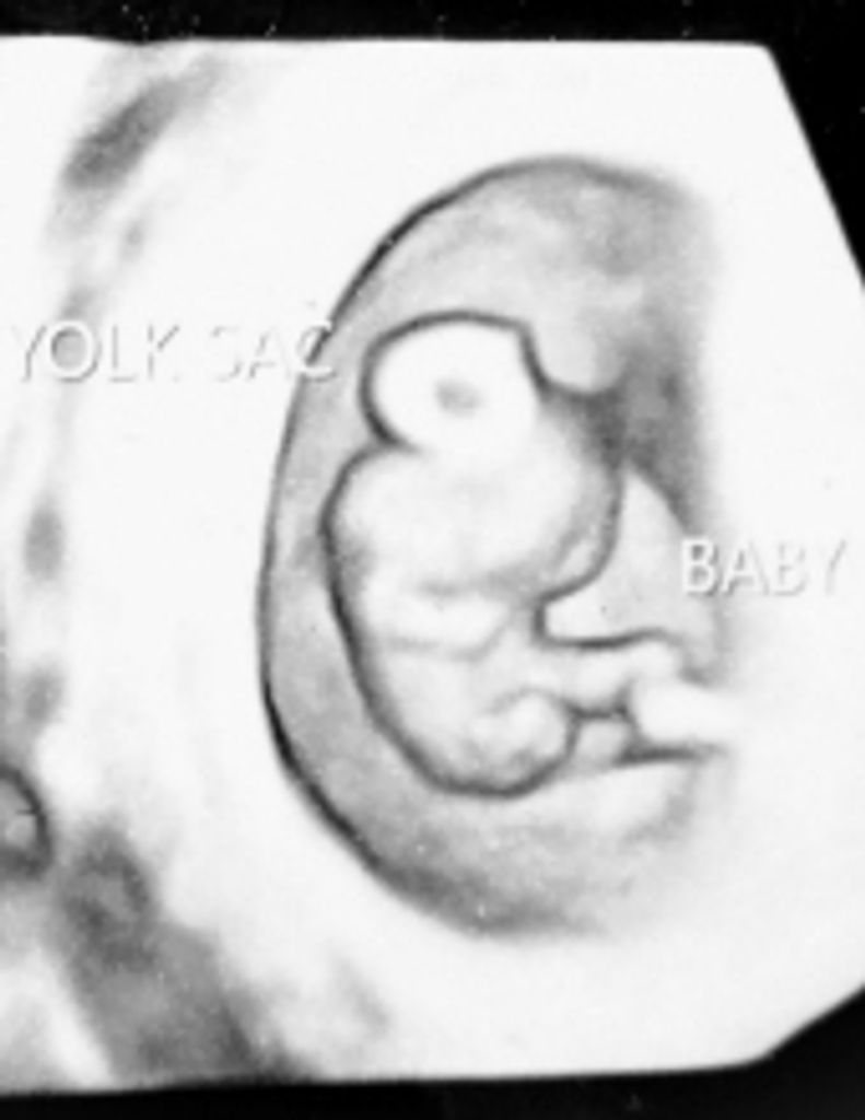Baby Angel Padilla Profile Photo