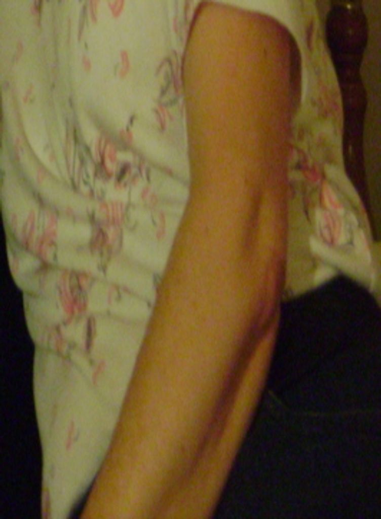 Martha  Fecser