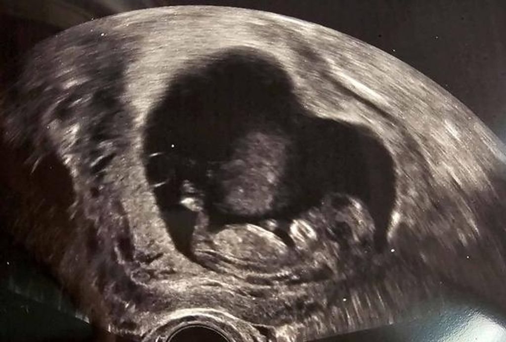 Benjamin John Contreras Profile Photo