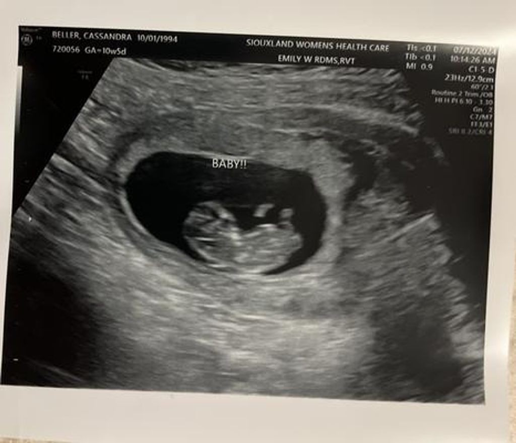 Ellie May Beller Profile Photo