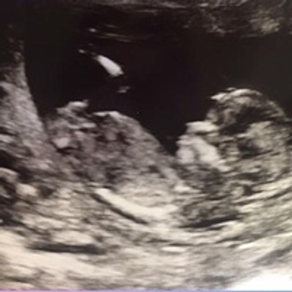 Baby Mason Thomas Irizarry Profile Photo