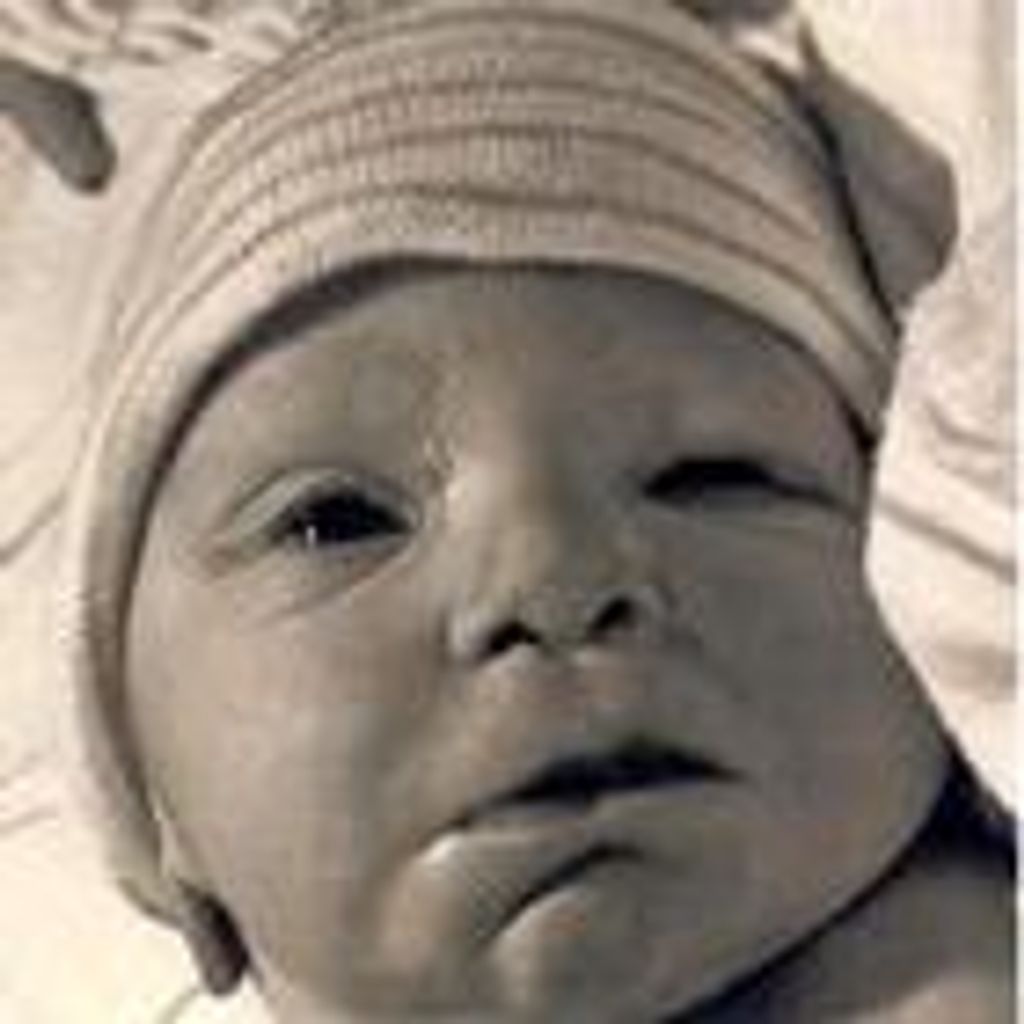 Infant Miskin