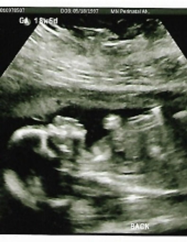 Baby Boy Greyson Sielaff