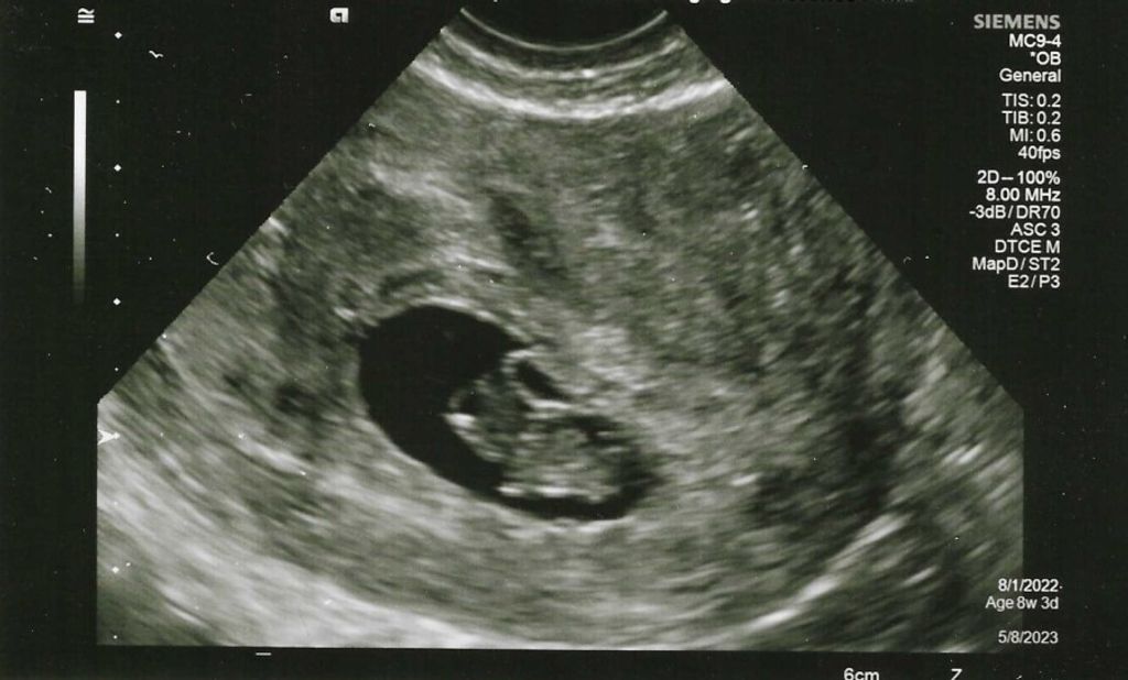 Baby Schmidt Profile Photo
