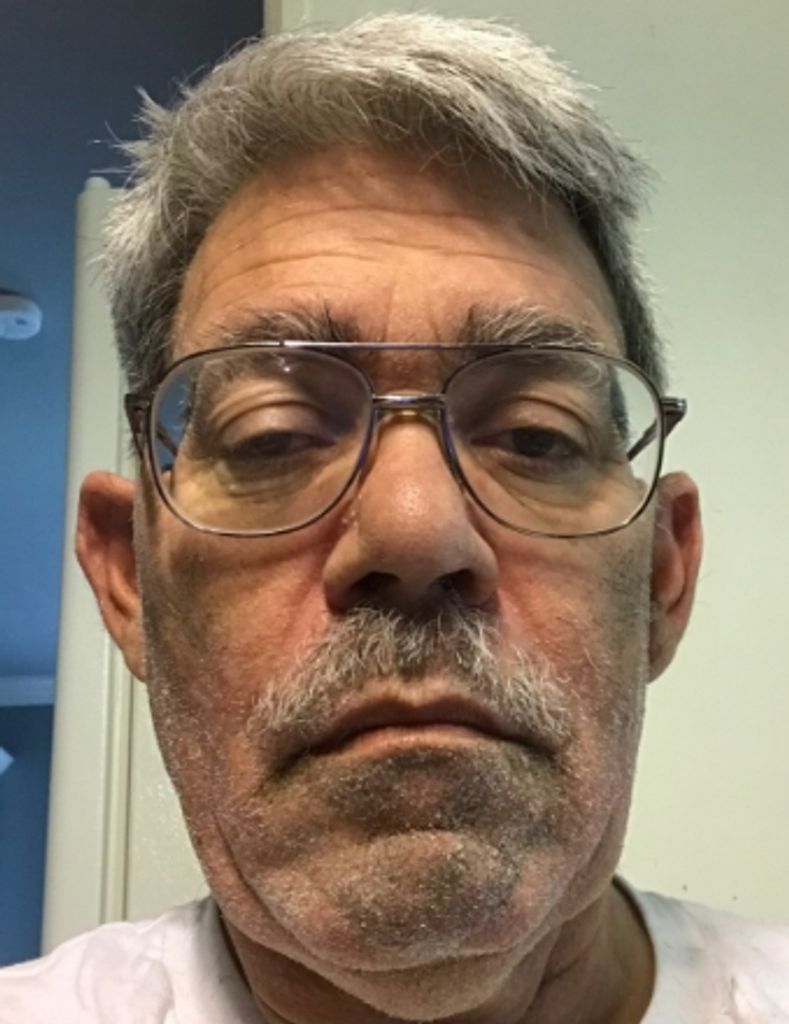 Raynaud Fisher Henton