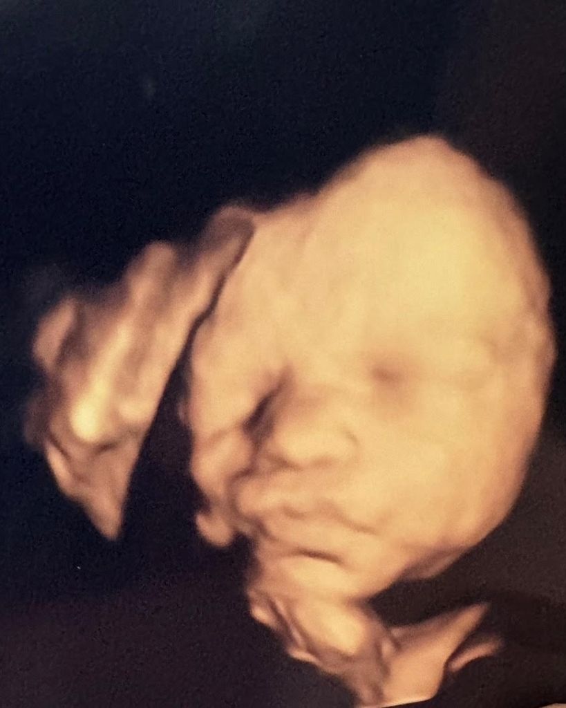 Baby Ella Grace Philmon