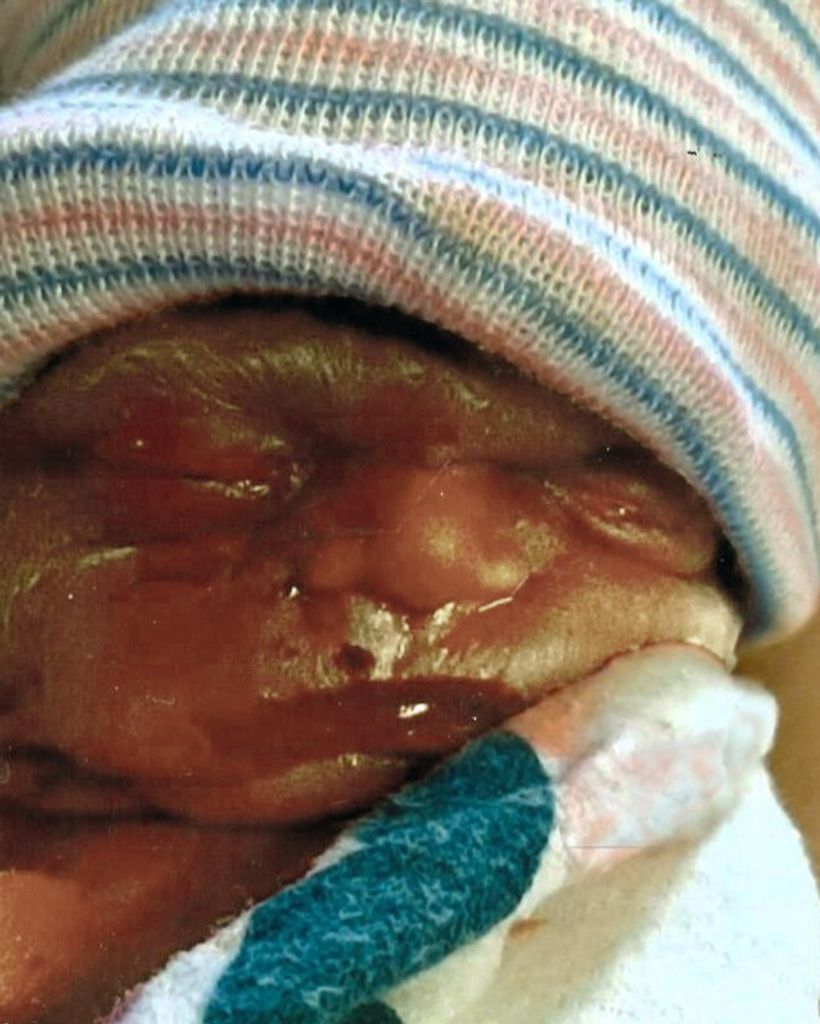 Raelynn Hope Nolan