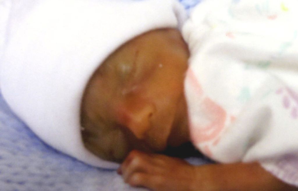 Anthony Jaxson Molloy
