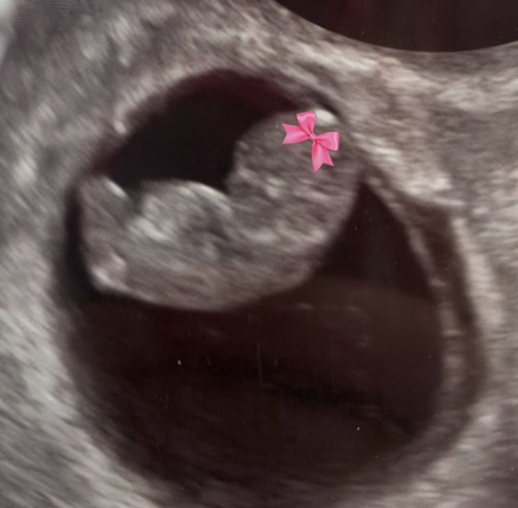 Nevaeh Skye Wendt Profile Photo