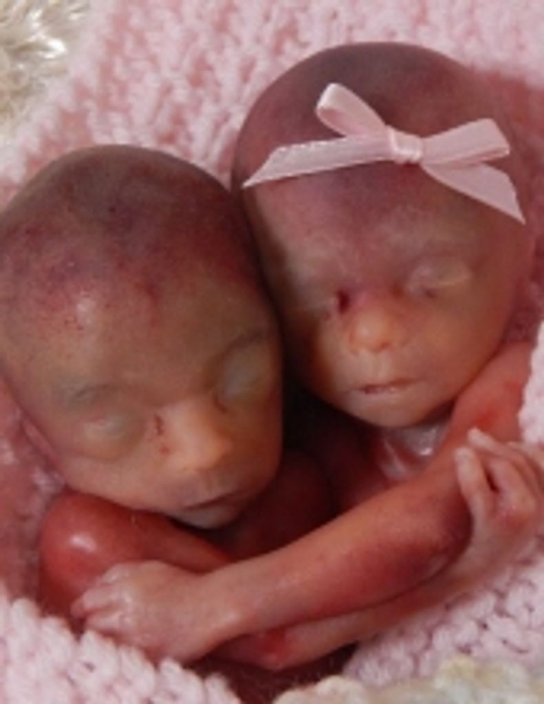 Phillip & Paisley Vouers