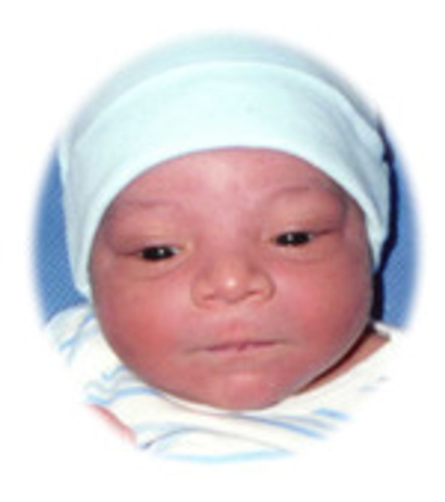 Carter Shuvo Fischer