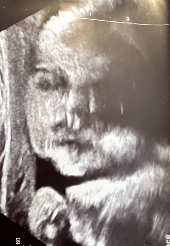 Emery Pearl Wilson Profile Photo