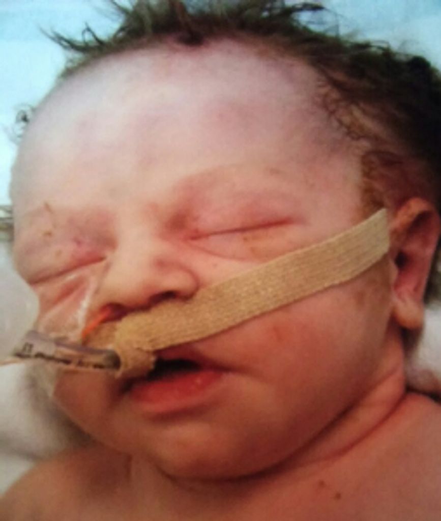 Mckynzie Lynn Upton