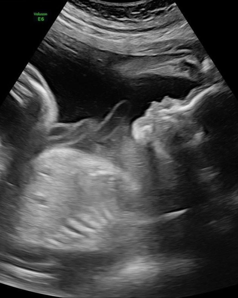 Greyson Jamiere Demeritt