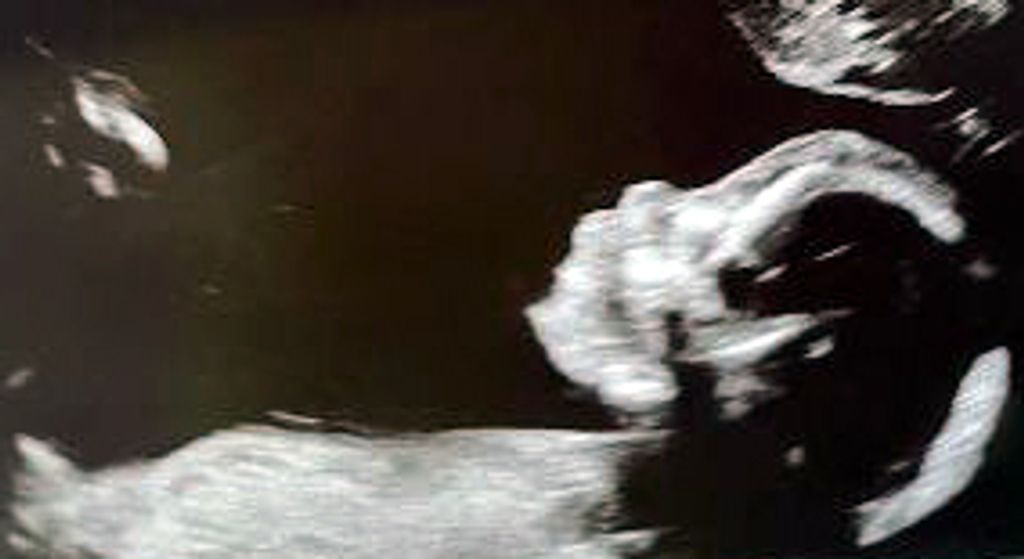 Baby Skye Dedrick