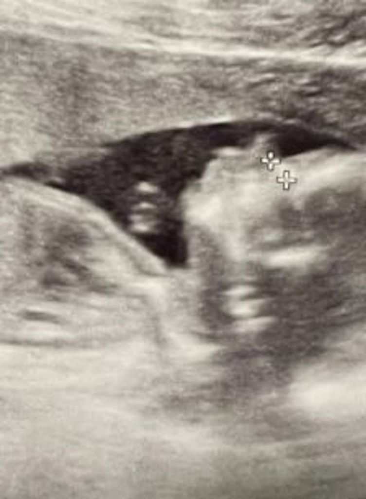 Brinley Rae Gortman Profile Photo