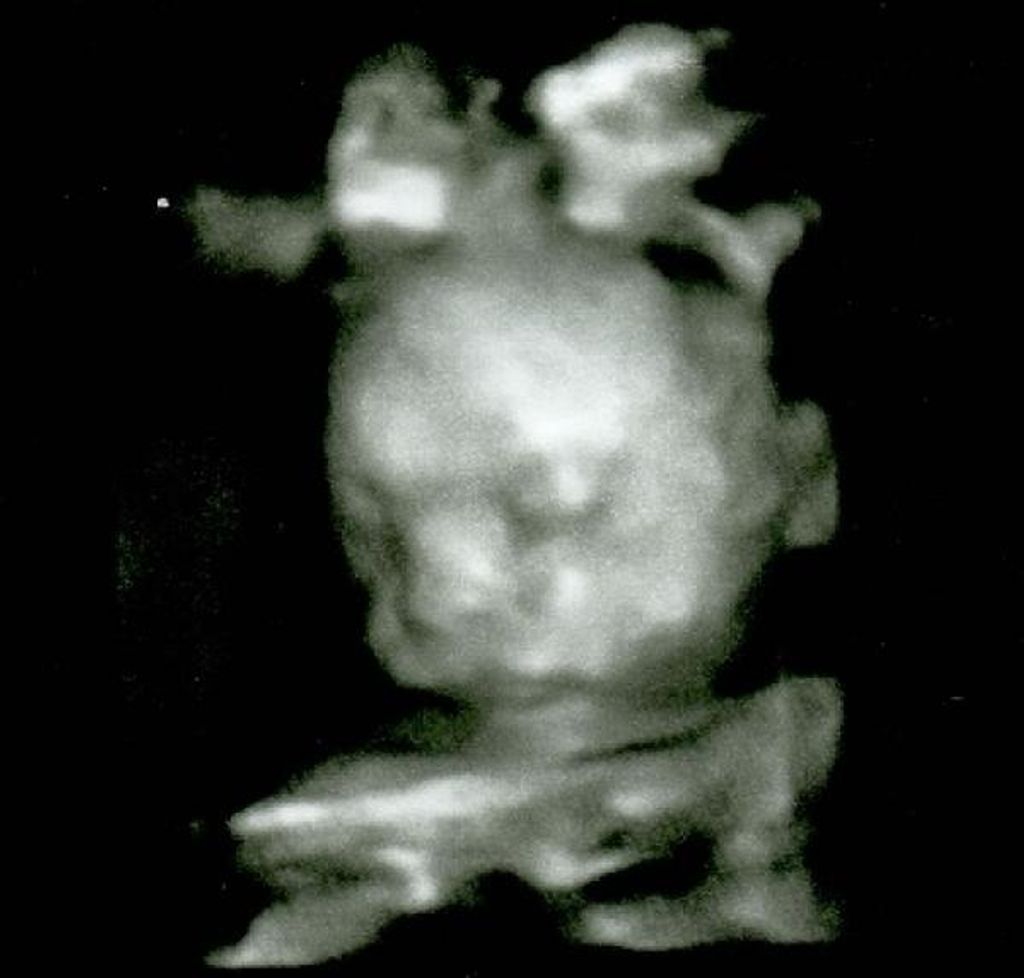 Elyjah James Nehman