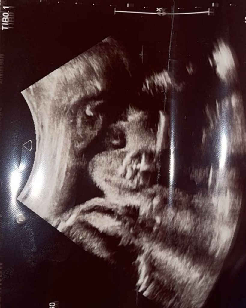 Infant Milo Cole Ward
