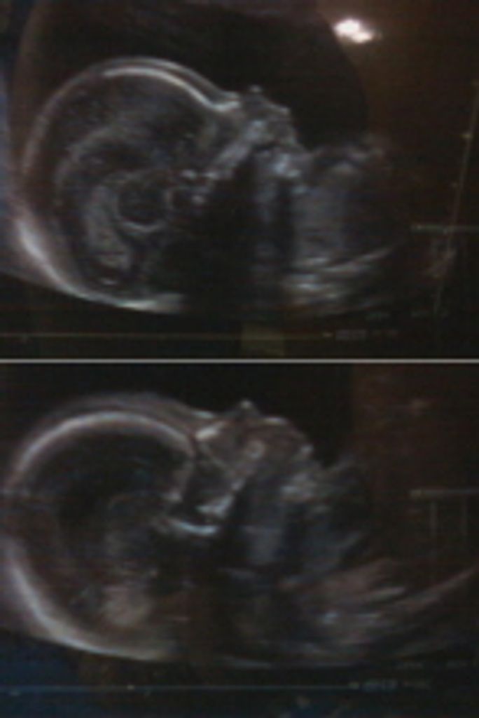 Jeremiah Jr. And Rayne Mystikal Sterzinger