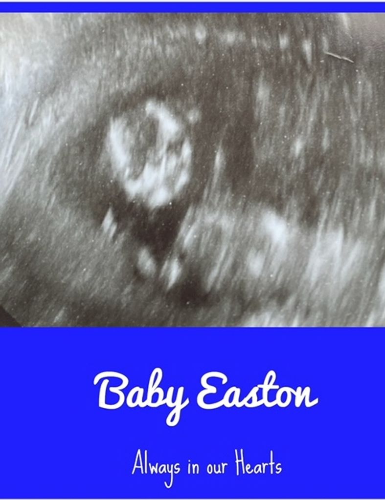 Easton Daniel Steen Profile Photo