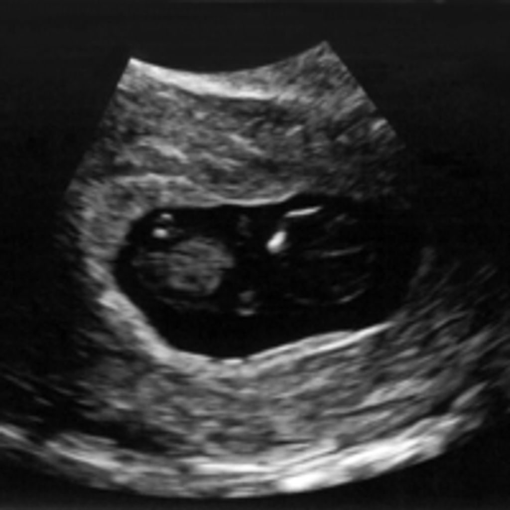 Baby Sky Norton-Grymala Profile Photo