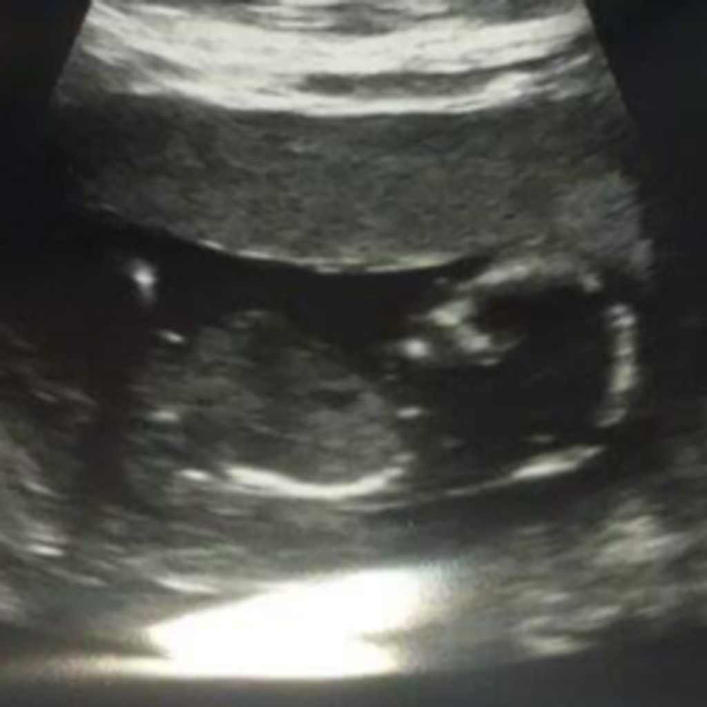 Blaine Paul Richoux Jr.