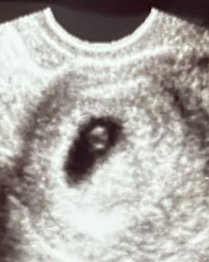 Baby Para Profile Photo