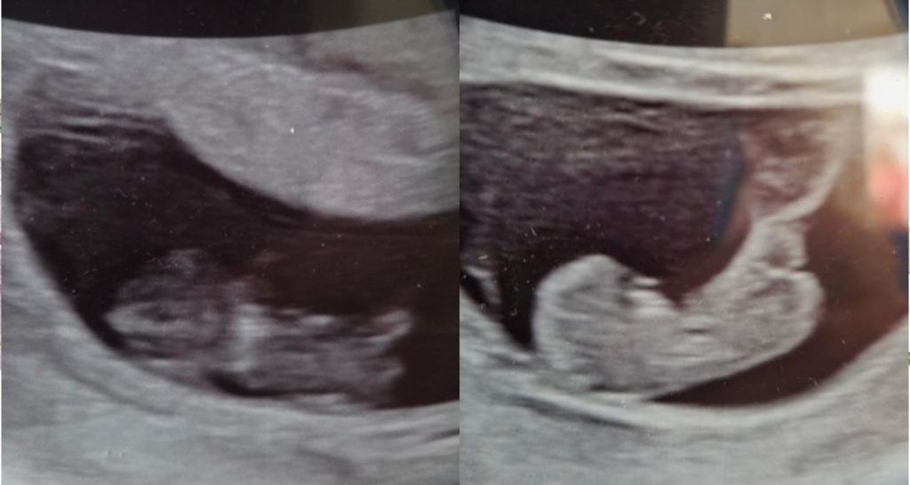 Amelia Faye Robinson And Faith Lynn Robinson