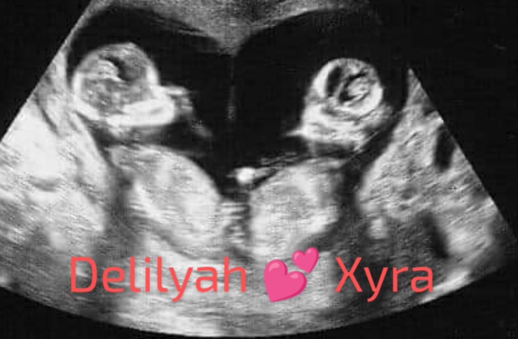 Xyra Dezirey Gaither And Delilyah Lavonne Gaither Profile Photo